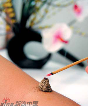 節(jié)氣灸” 冬至，你灸了嗎？