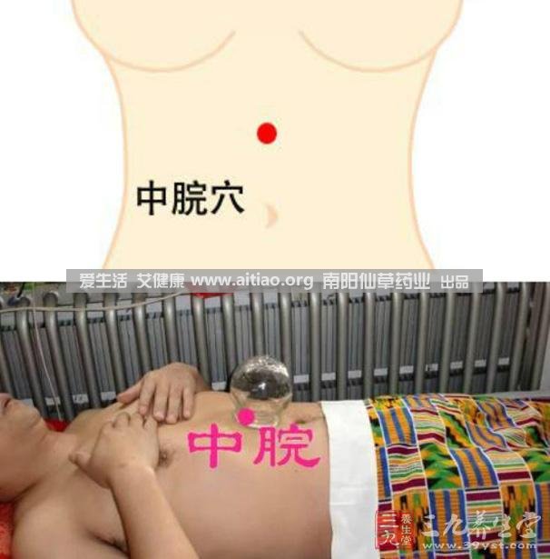 中脘穴位于腹部正中線，臍上4寸的位置上。每天艾灸10-15分鐘，能有效緩解胃部不適的癥狀，同時(shí)有助于祛濕。